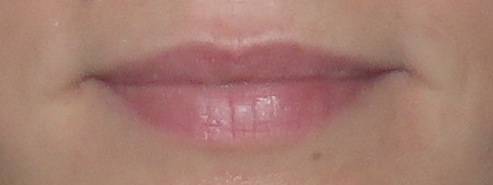 lèvres pulpeuses marseille 